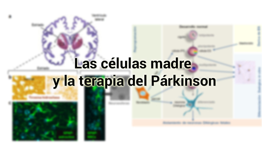 Las células madre y la terapia del Párkinson