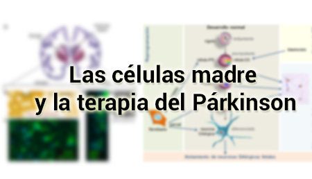 Las células madre y la terapia del Párkinson